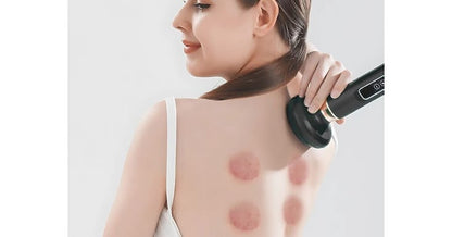 Aparat de Masaj Electric PREMIUM, 12 trepte de intensitate, drenaj limfatic si anticelulita, cupping terapeutic, bile de otel, design portabil, reincarcabil, ideal ingrijire personala si relaxare, Negru